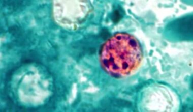 COUNTY-BY-COUNTY: Diarrhea-causing parasite flares up across Central Florida