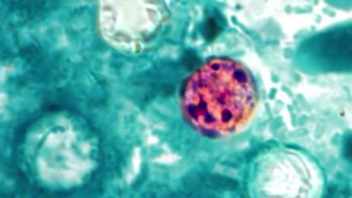 COUNTY-BY-COUNTY: Diarrhea-causing parasite flares up across Central Florida