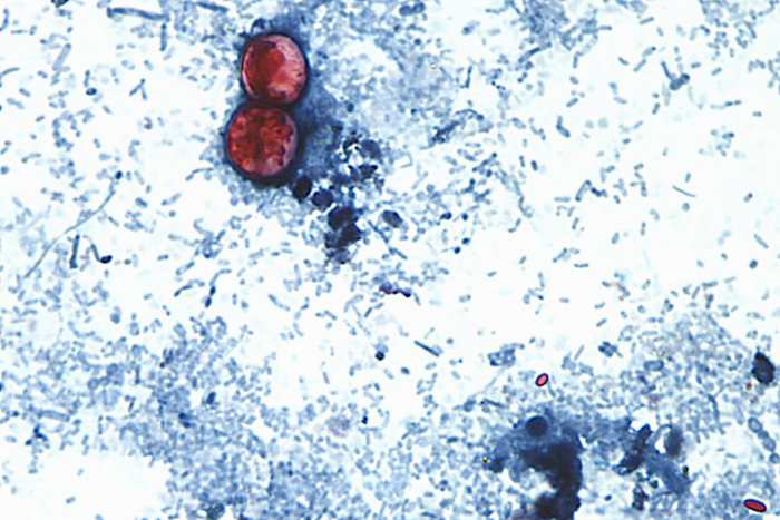 Florida averaging over 50 cases a week linked to diarrhea-causing parasite since start of summer