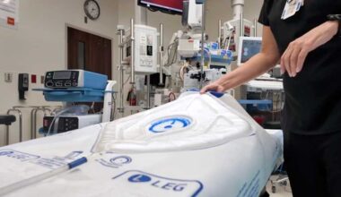 Orlando Health Introduces New Device Designed to Improve Detection of Blood Loss During C-Sections