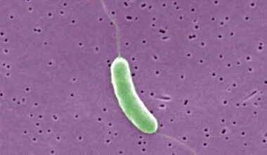 Florida reports second death from Vibrio vulnificus bacteria