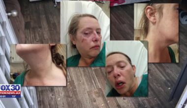 Disabled woman struck with tree branch during workday