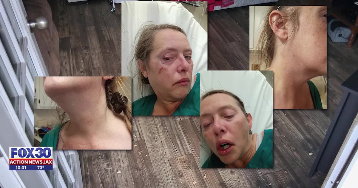 Disabled woman struck with tree branch during workday