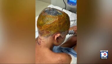 Mother of 9-year-old boy mauled by dogs in Bimini gives update on his recovery