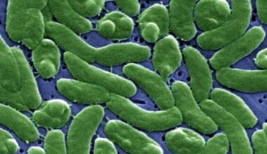 Florida reports additional Vibrio vulnificus case in Santa Rosa County