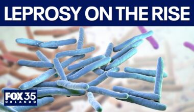 Florida leprosy cases are on the rise