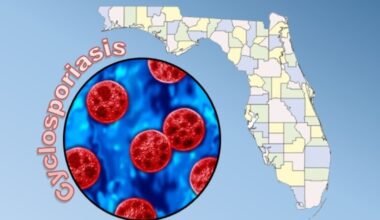 Florida cyclospora surges again with 87 new cases. More states link the cause to lettuce