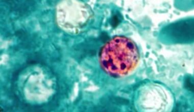 Florida Cyclosporiasis cases rise to 460: Here’s a county-by-county breakdown