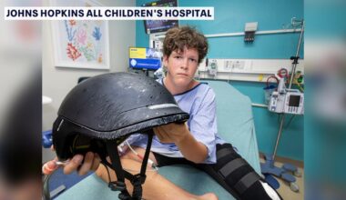 Teen credits helmet for saving his life after e-bike crash, doctors warn of injury increase