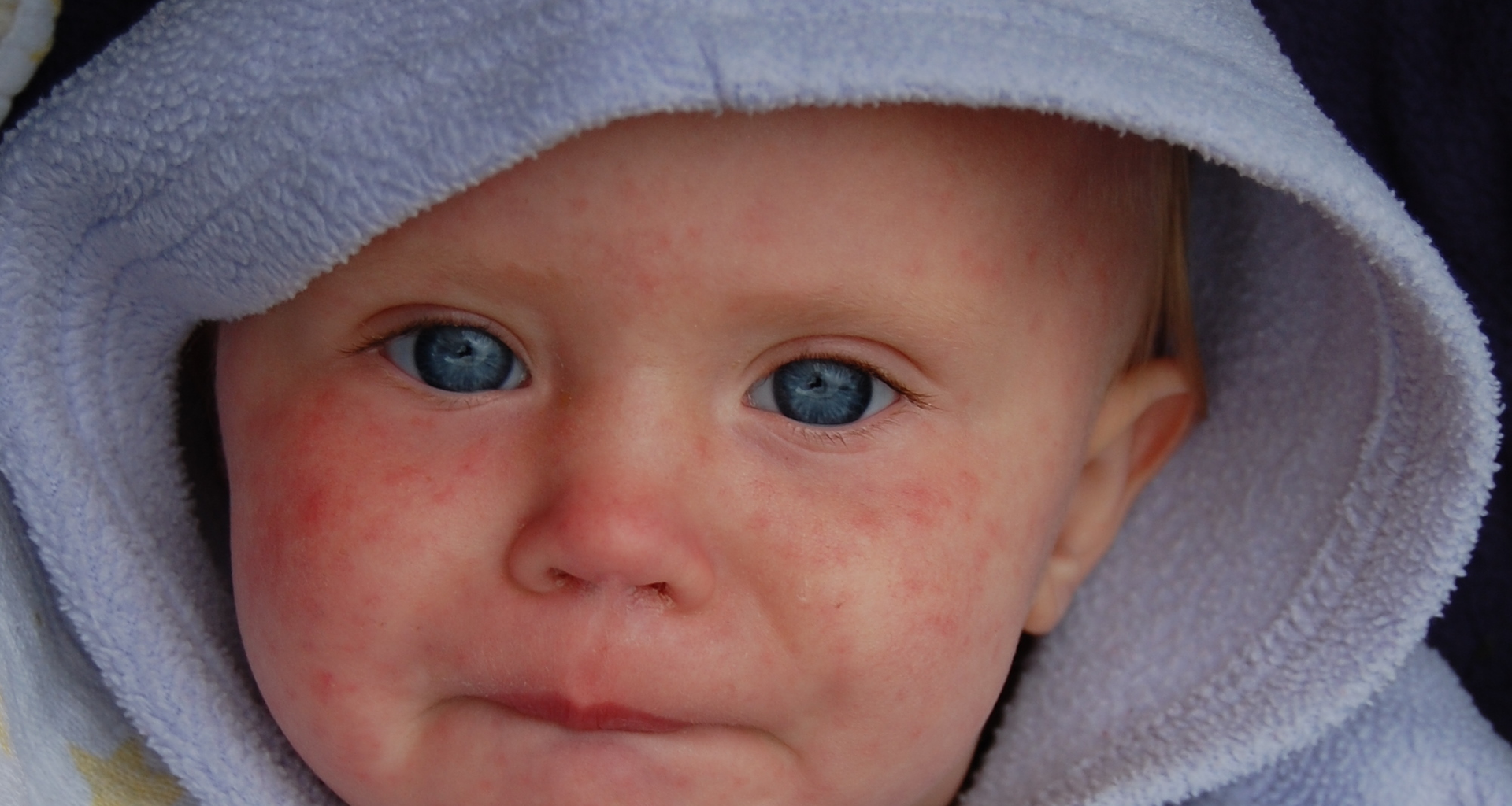 DeSantis administration removes child vaccine exemptions based on 'moral or ethical beliefs'