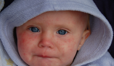 DeSantis administration removes child vaccine exemptions based on 'moral or ethical beliefs'