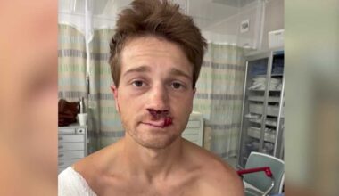 Winter Garden cyclist says helmet saved him in hit-and-run