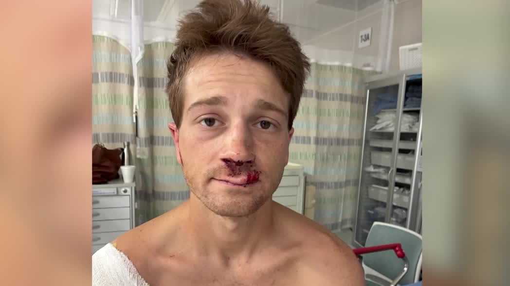 Winter Garden cyclist says helmet saved him in hit-and-run