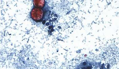 FDA declares cyclospora outbreak over; six cases in Charlotte County | Port Charlotte News