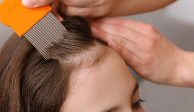 Let’s talk about lice: What Key Biscayne parents should know | Health