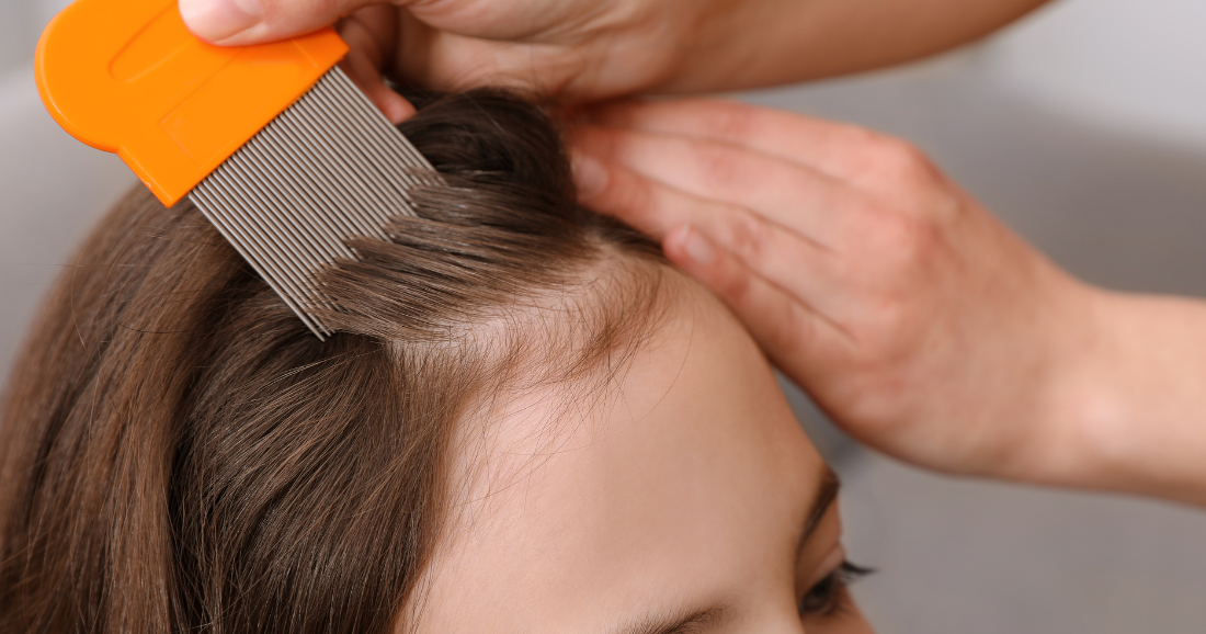 Let’s talk about lice: What Key Biscayne parents should know | Health