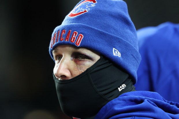Cubs third baseman Alex Bregman watches the fourth inning against the Marlins from the dugout at Wrigley Field on Sept. 22, 2026, in Chicago. He was injured in the face by a foul ball on Sept. 20. (John J. Kim/Chicago Tribune)