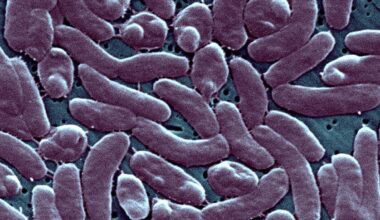 4th Florida death linked to ‘flesh-eating’ bacteria this year is person in Broward – NBC 6 South Florida