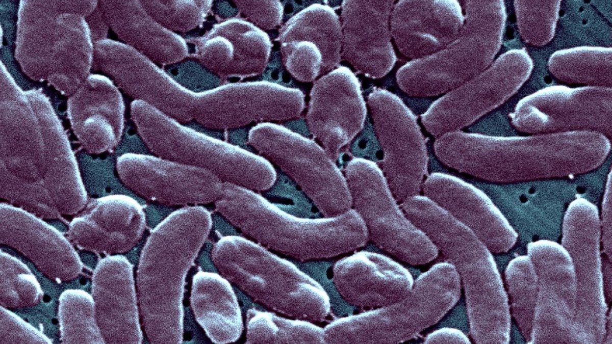 4th Florida death linked to ‘flesh-eating’ bacteria this year is person in Broward – NBC 6 South Florida
