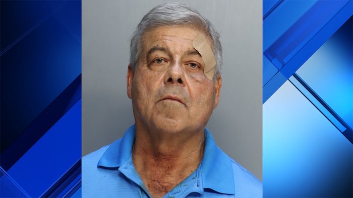 Man, 72, accused of attacking driver with baseball bat during Miami-Dade road rage incident