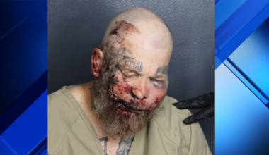 Fort Lauderdale man arrested after attacking officer at hospital, cops say