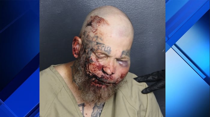 Fort Lauderdale man arrested after attacking officer at hospital, cops say
