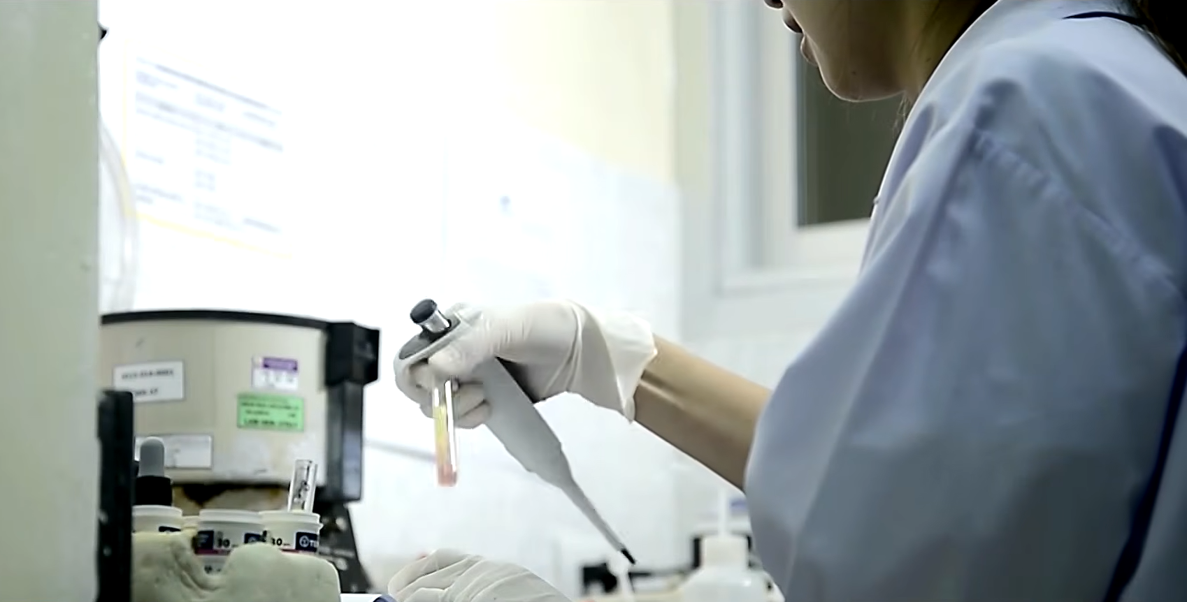 An unexpected blood-type result prompted a Florida couple to seek further testing after their baby’s birth. (Photo: CBS News) An unexpected blood-type result prompted a Florida couple to seek further testing after their baby’s birth.