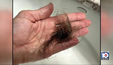 What’s really causing your hair loss? Dermatologist separates fact from fiction