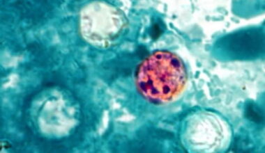 Confirmed and probable cases of cyclosporiasis hit 500 in Florida