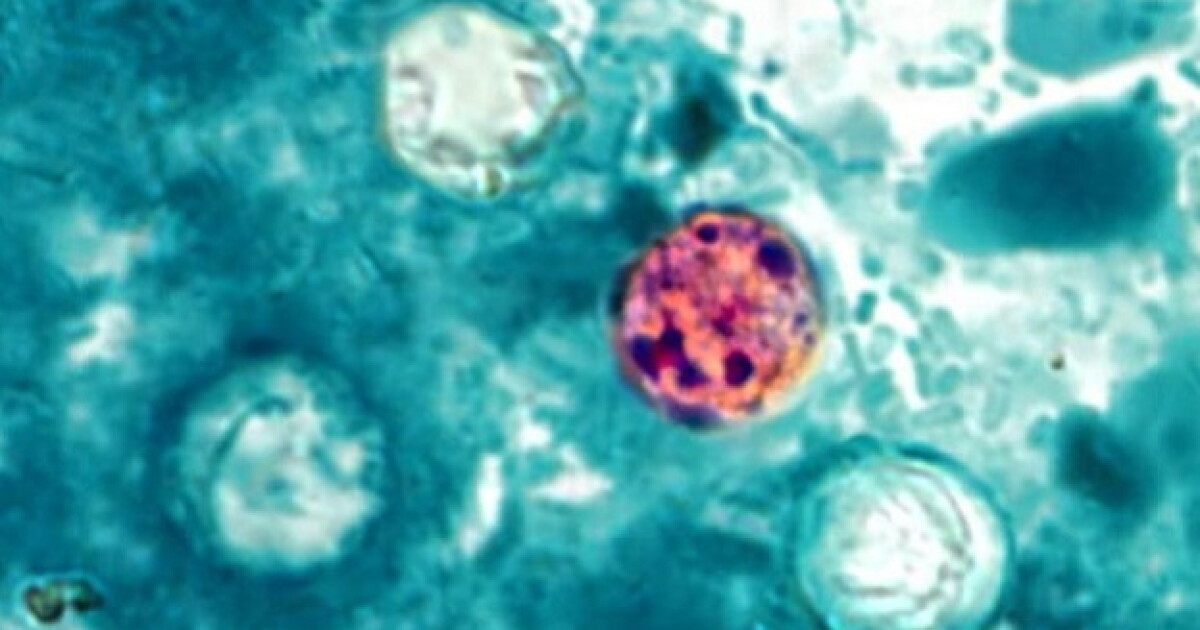 Confirmed and probable cases of cyclosporiasis hit 500 in Florida