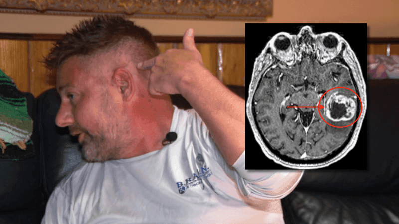 Matt Elliott was diagnosed this year with glioblastoma, an aggressive, fast-growing grade 4 brain cancer. The former bar manager described struggling to speak after surgery and initially believing his diagnosis was an isolated case. Meeting other local patients changed that. (WPEC)