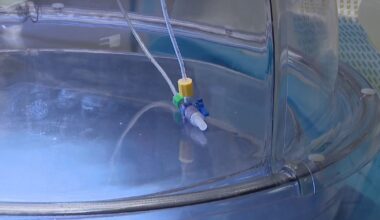Tampa General lung transplants: New technology tests donor organ performance