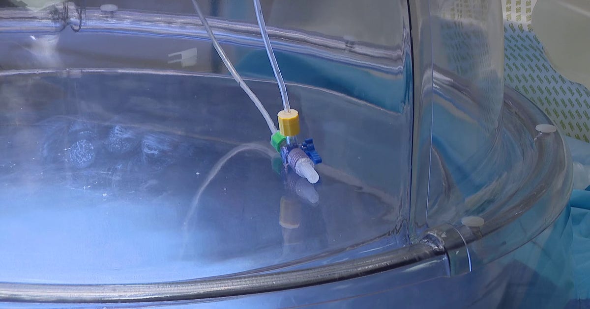 Tampa General lung transplants: New technology tests donor organ performance