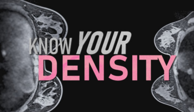 Your mammogram says you have dense breasts. Now what?