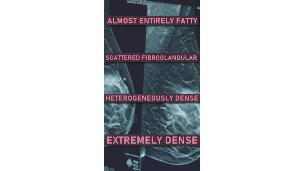 When it comes to breast density, you can fall into one of four categories. Your density can...