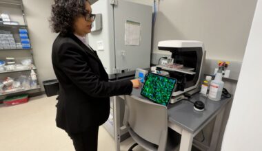 USF heart valve research offers hope for patients