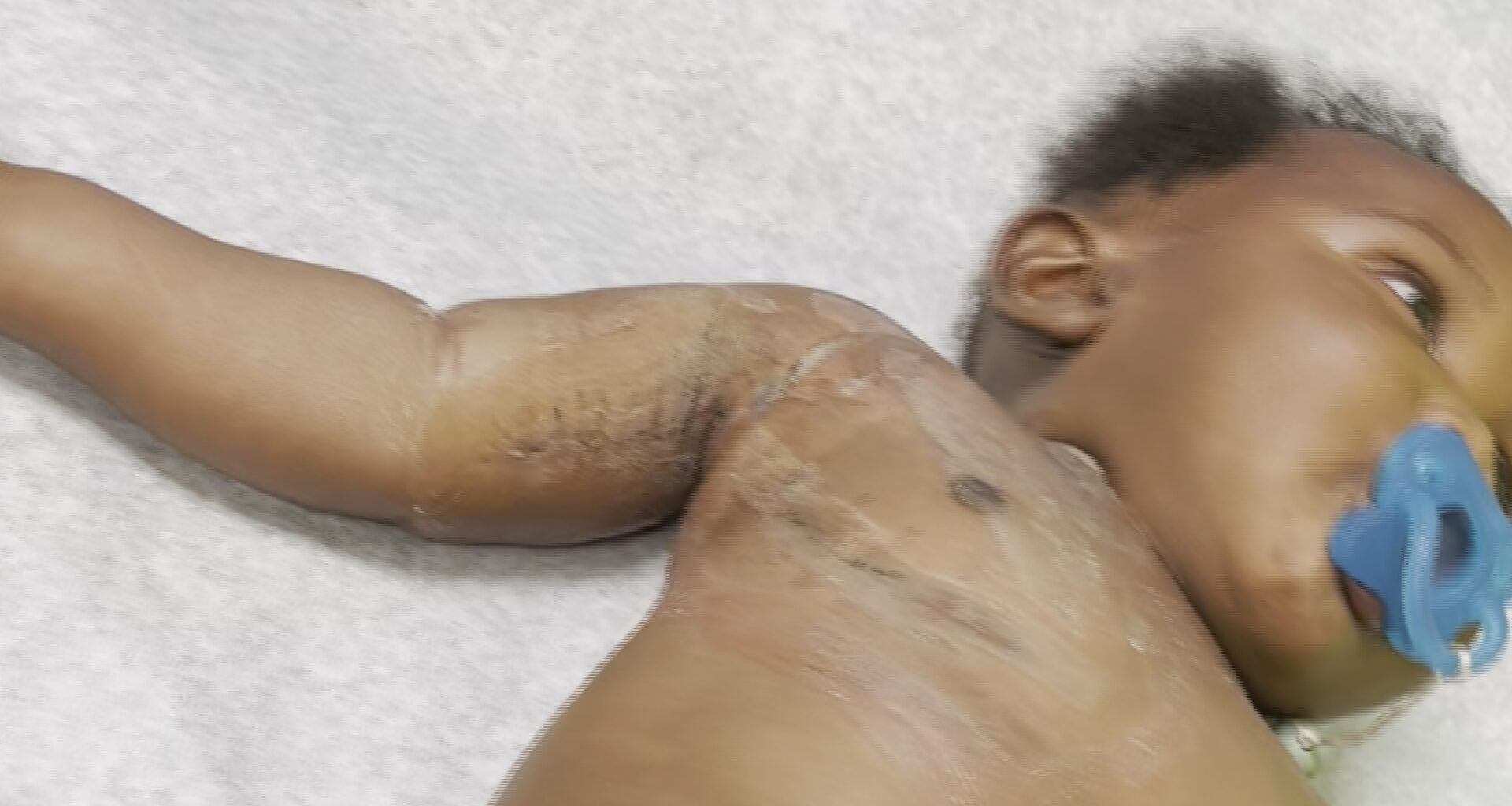 Tampa mom calls for stronger legislation after uninsured midwife injures child
