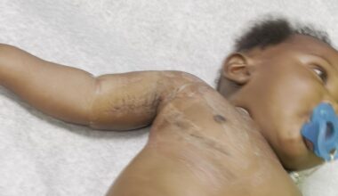 Tampa mom calls for stronger legislation after uninsured midwife injures child