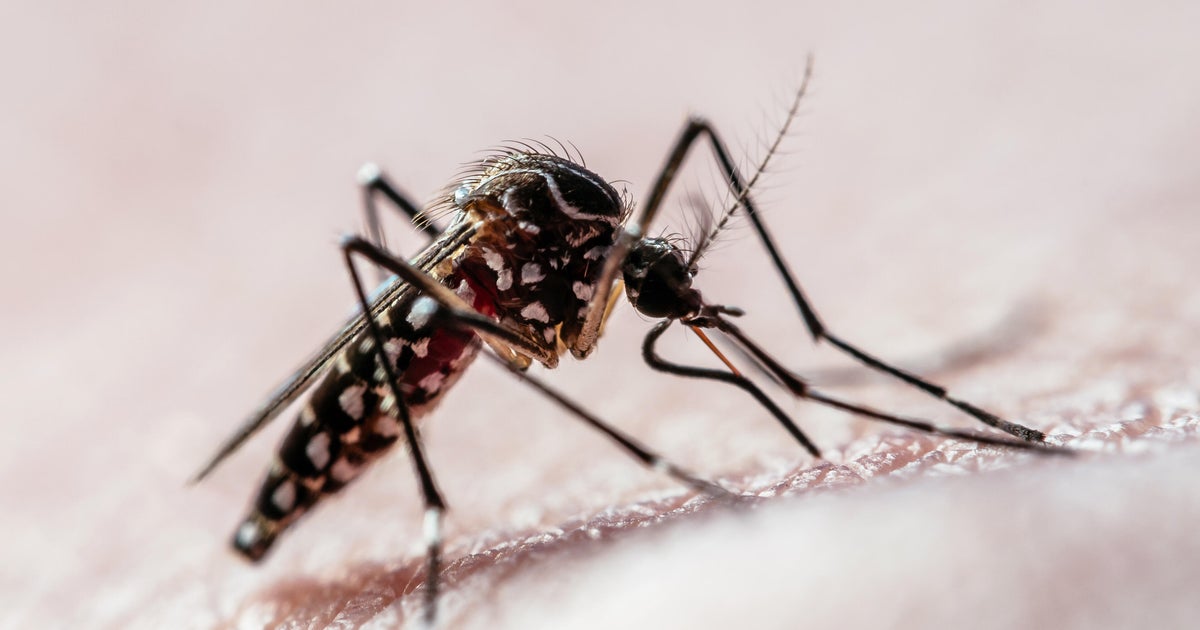 Florida confirms locally acquired dengue case in Broward County, prompting mosquito advisory