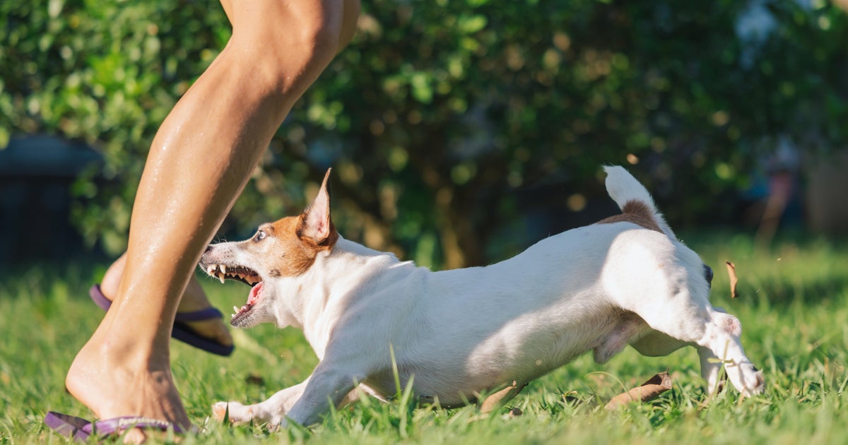 Dog on the loose after girl suffers multiple bites in northwest Miami-Dade, deputies say