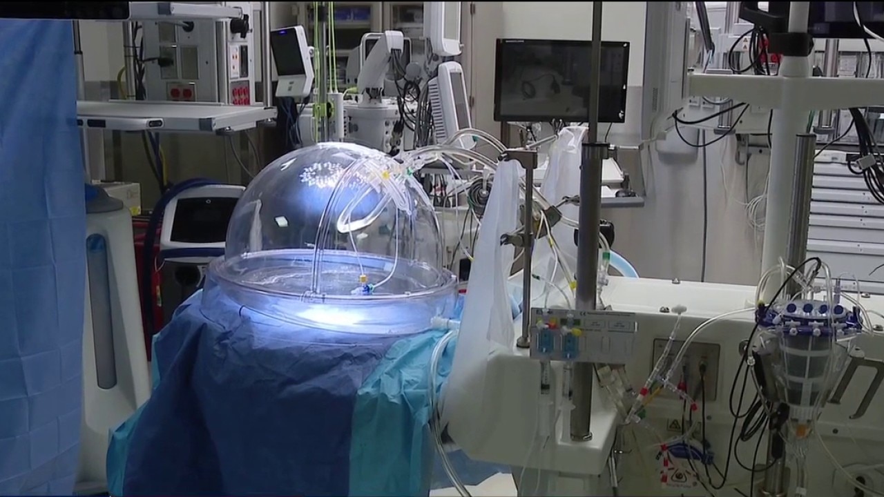 Tampa General improving lung transplants