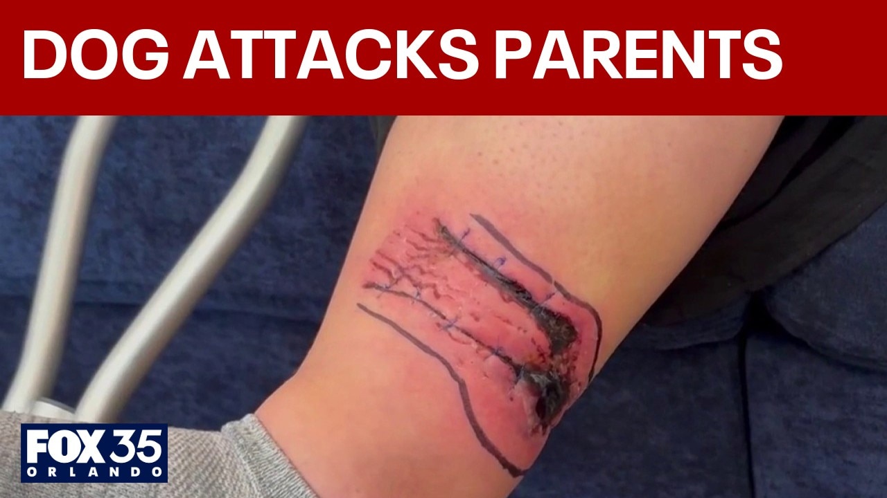 Parents say they were attacked by dog while shielding baby