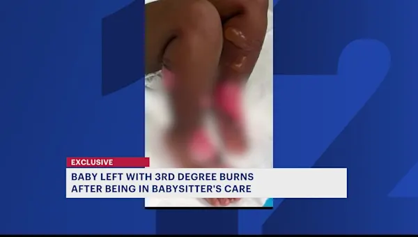 Brooklyn family seeks answers after toddler comes home from babysitter with third-degree burns