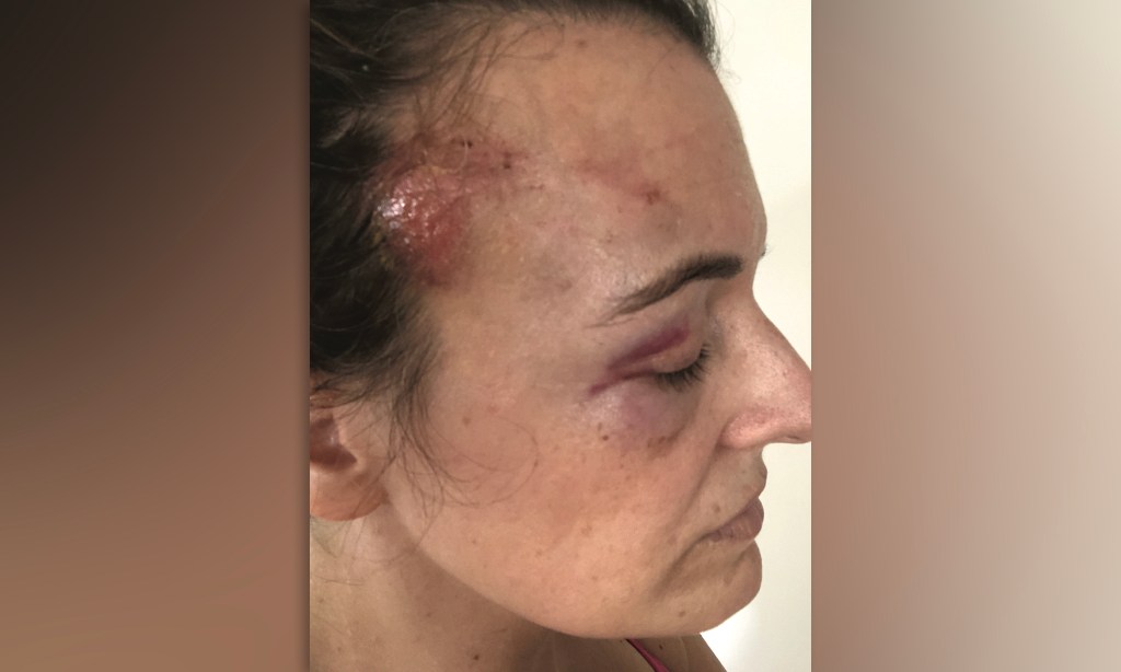 NYC ordered to pay $2.5M to George Floyd protestor in excessive force lawsuit