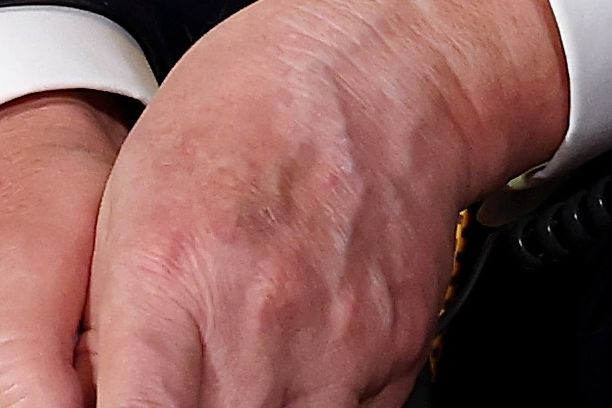 President Trump Joins NORAD Santa Calls