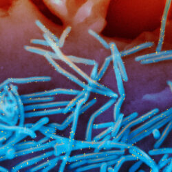 This electron microscope image provided by the National Institutes of Health shows human respiratory syncytial virus (RSV) virions, colorized blue, and anti-RSV F protein/gold antibodies, colorized yellow, shedding from the surface of human lung cells. National Institute of Allergy and Infectious Diseases, NIH via AP, File