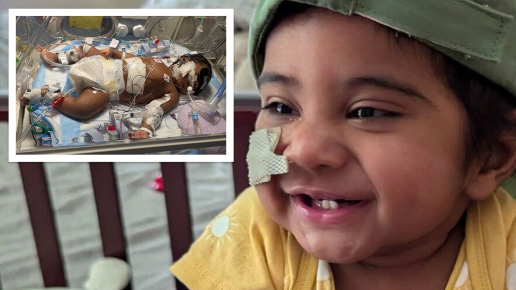Only hope for infant with rare new genetic disease was risky tranplant at NYC hospital