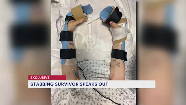 Stabbing survivor speaks out after alleged attacker released without bail
