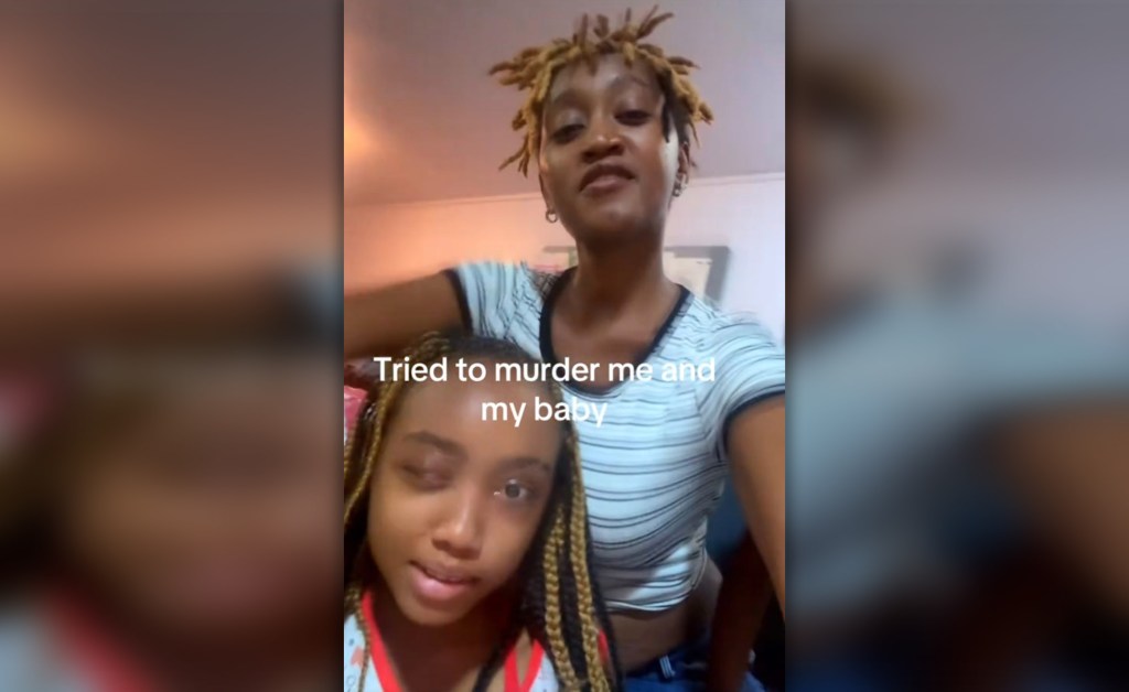 Beaten, tortured and traumatized, 12-year-old Bronx girl makes heroic recovery: Mom