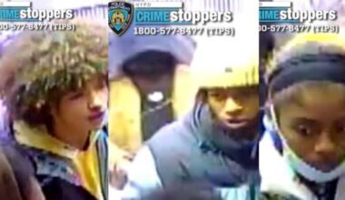 Staten Island man permanently scarred after liquid attack; suspects at large